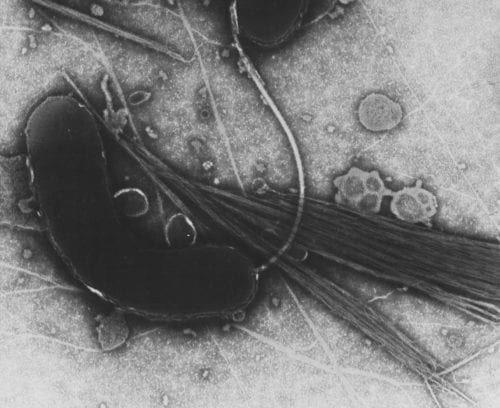 An electron microscope image of Vibrio cholera that has been negatively stained. Vibrio cholera is the bacteria responsible for the gastrointestinal disease cholera.