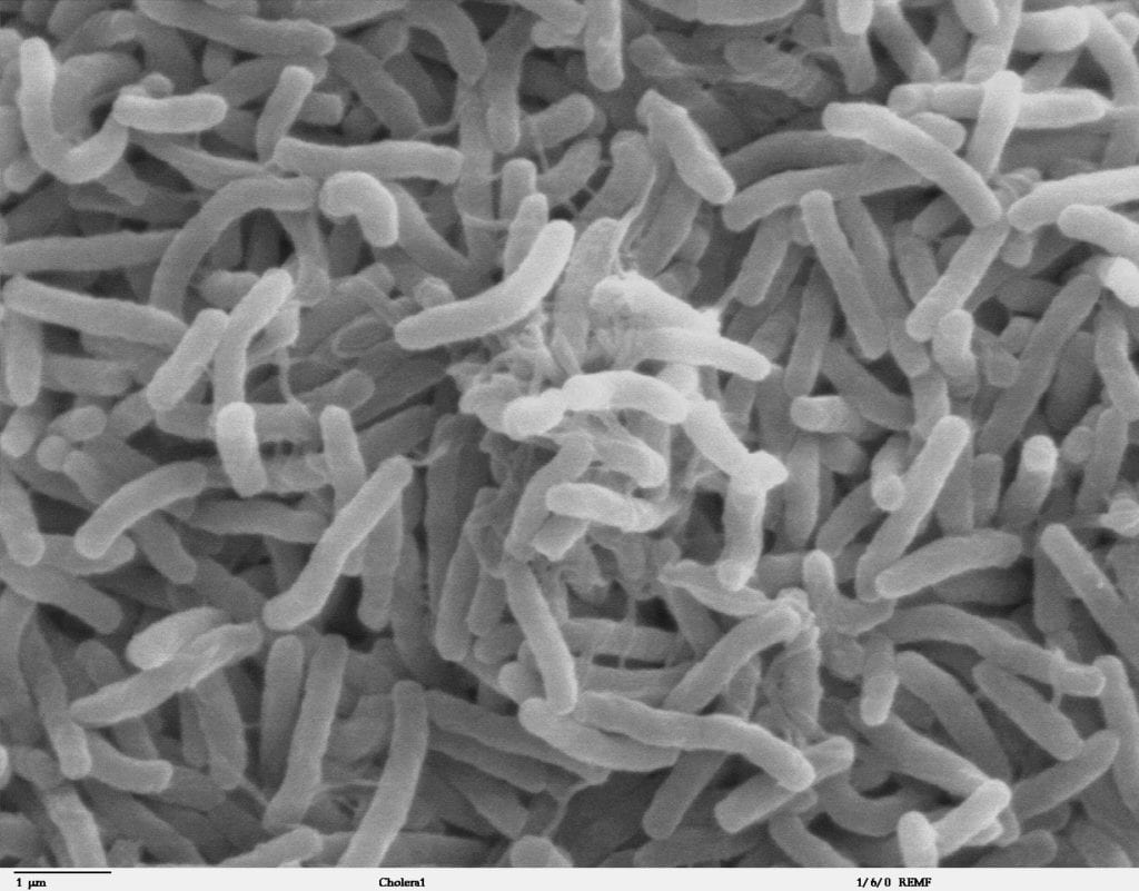 A scanning electron microscope image of Vibrio cholerae bacteria. Image Credit: Dartmouth Electron Microscope Facility.