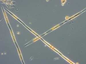 Psuedo-nitchia found in water sample collected by Zach Forster on Aug. 26, 2015. Image Credit: Zach Forster, WDFS