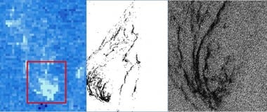 Mockup of three satellite images of Sargassum. Credit: DEVELOP.